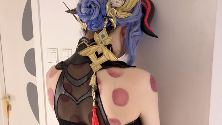 Đi giác hơi đây~ Mọi người ở hội chợ cosplay làm như không thấy nhé~ Giác hơi xong mà còn phải cospl