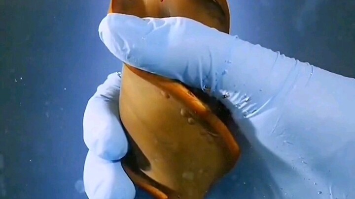 长得像开瓶器的鲨鱼蛋，螺旋状的