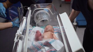 【宇哥】小宝宝的肠子长到了体外，该如何修复？医生犯了愁……《良医S2-15》