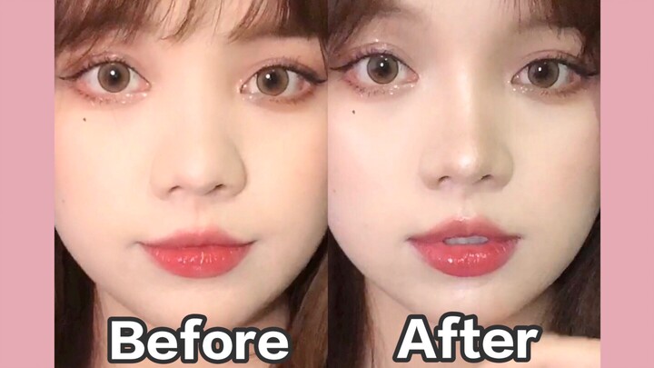 Teknik “Gunung Muncul dari Tanah” | Gadis Hidung Bombay, Sembuh! Ayo Datang!