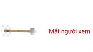 Dương FG và chứng bệnh OCD | Cre: Dương FG