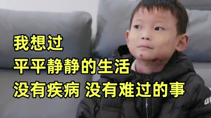 “Those kids are scared of my wounds and keep staying far away from me.”