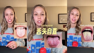 Everyone, come check out your own tongues! 👅