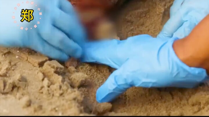 Man Basking in the Sun on the Beach Suddenly Struck by Lightning