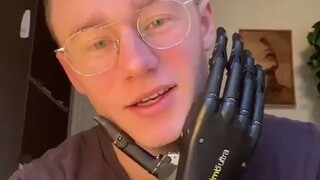 رجل معاق وذراعه الروبوتية
