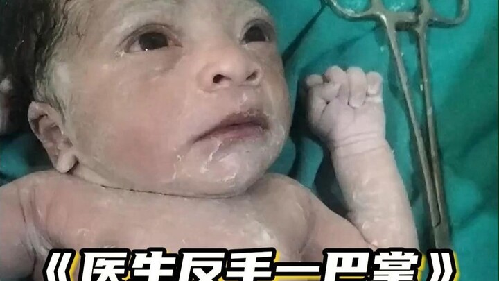 Em bé vừa chào đời, bác sĩ phát hiện có điều gì đó không ổn, tát em bé bằng mu bàn tay, và em bé đã 