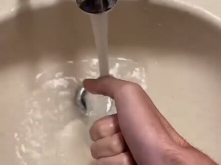 นิ้วมือของบางคนเกิดมาไม่เหมือนกับคนอื่น #เรื่องแปลกคนแปลก #นิ้วติดกัน #ได้ความรู้ใหม่