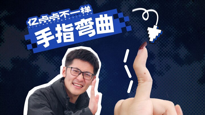 Video động | Kỳ lạ xương khớp? Tay bạn có thể uốn cong như thế này không?