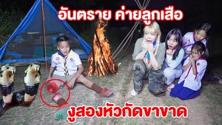 อันตราย เข้าค่ายลูกเสือ วันเด็ก งูสองหัวกัด ขา ต้องตัดขา จะรอดมั้ย