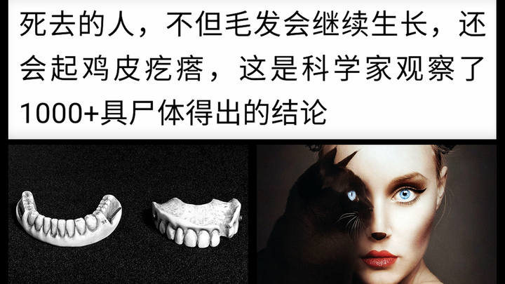 【ตอนที่ W】เกร็ดความรู้ชวนขนลุกเมื่อคิดให้ลึก: ศพยังสามารถขนลุกได้!