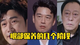 Beberapa Tahap Perawatan Mata