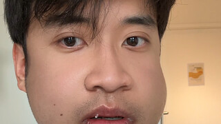 The cover photo is definitely not a special effect!!! The bee puppy after orthognathic surgery...