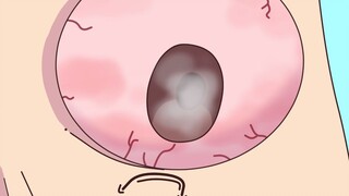 Get a cornea replacement today