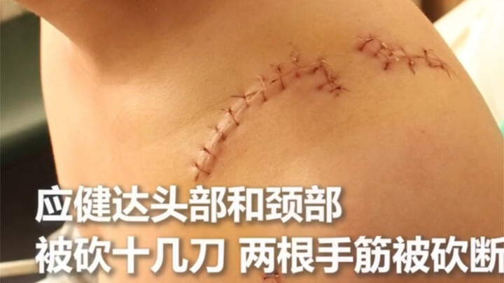 أنا متأثر لدرجة أن قلبي ينفطر، هذا هو البطل الحقيقي!!