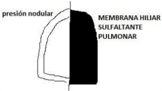 hipertensión pulmonar