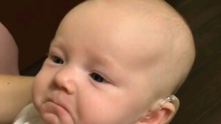 The congenitally hearing-impaired baby heard his mother's voice for the first time after wearing a h