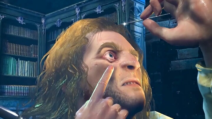 Memasukkan jarum tumpul ke antara bola mata dan tengkorak