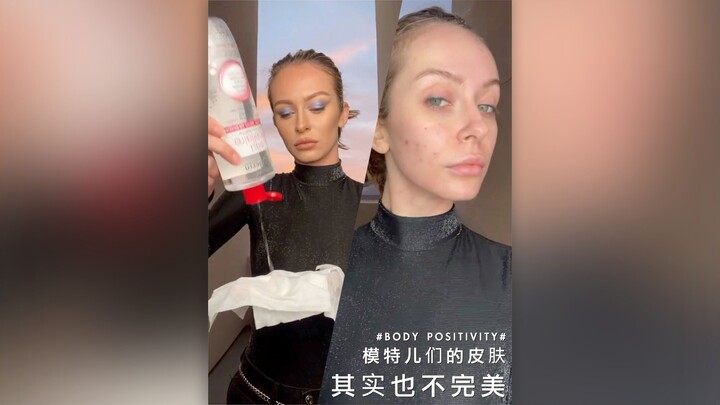 #Body Positivity# Even models’ skin isn’t perfect