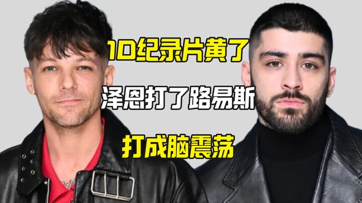 A jerk caused Louis to suffer a concussion, and the One Direction documentary fell through.