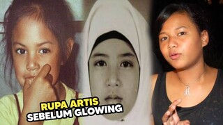 Dulu Dekil dan Hitam! Perubahan 7 Artis Ini Sekarang Paling Ekstrem Setelah Terkenal