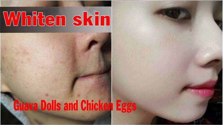 Whitening with Young Guava Dolls and Chicken Eggs #47