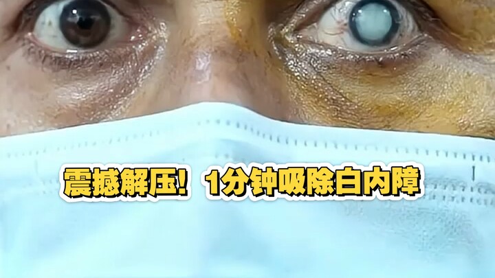 Soothing and Stress-Relieving Cataract Extraction