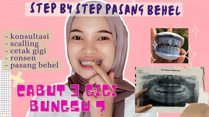 CABUT 3 GIGI BUNGSU ?? INI LOH STEP BY STEP PASANG BEHEL | Ayu Rahayu