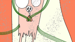 Achilles tendon surgery