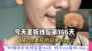 【vlog日常】切缝手术拆线后第146天之夏鸣星线下cos委托