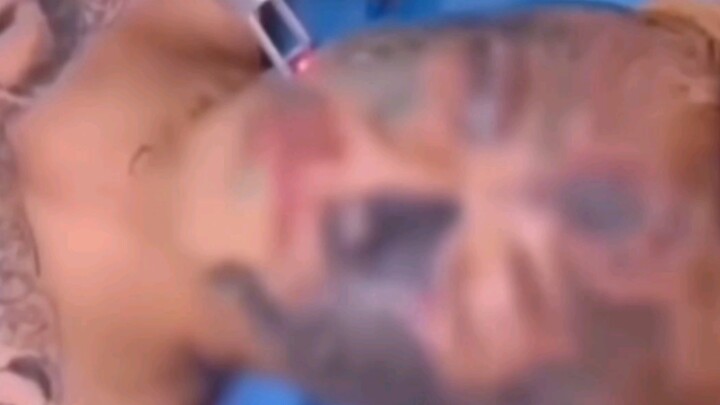 Bocah laki-laki berusia 14 tahun dengan tato di seluruh wajahnya, hidupnya hampir berakhir.