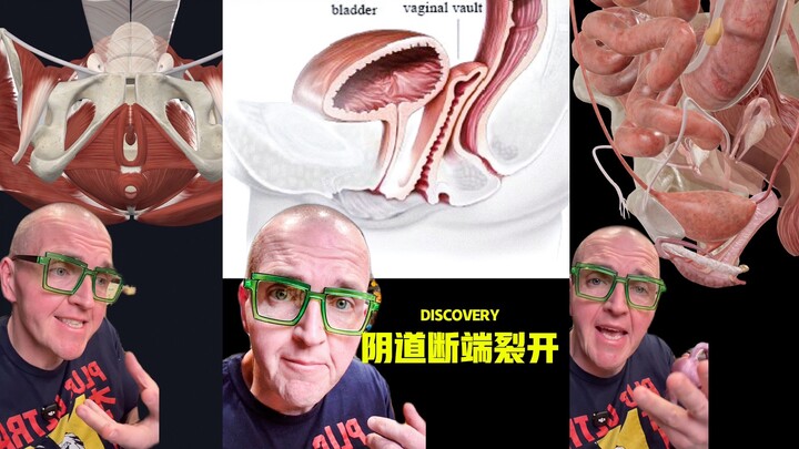 This may happen after a hysterectomy‼️