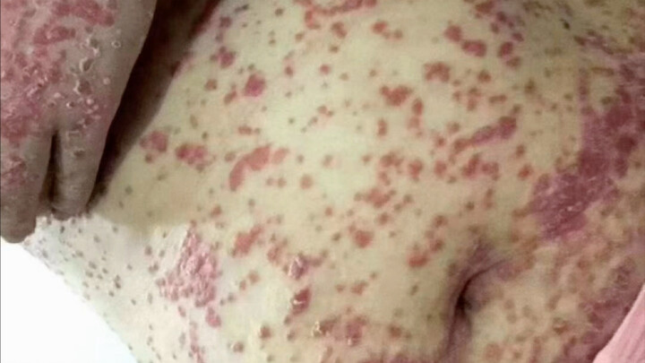 Hanya ingin bertahan hidup