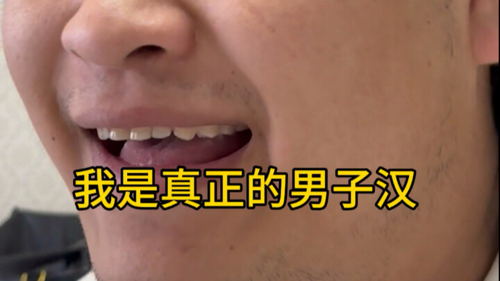 มือดำปะทะมือเหลือง