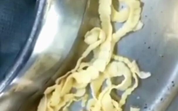 Ini dia cacing pita babi yang diangkat setelah operasi, silakan lihat semuanya!