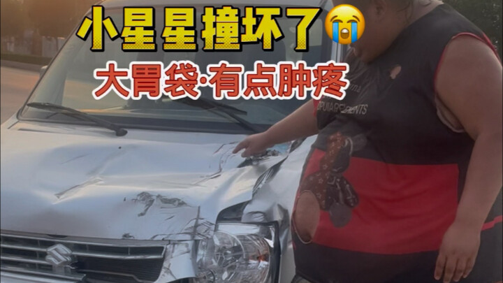 嗨，小星星前脸 撞坏了，我肚子大胃袋有点淤青肿疼，我人没有大碍 希望胃袋早日康复❤️‍🩹