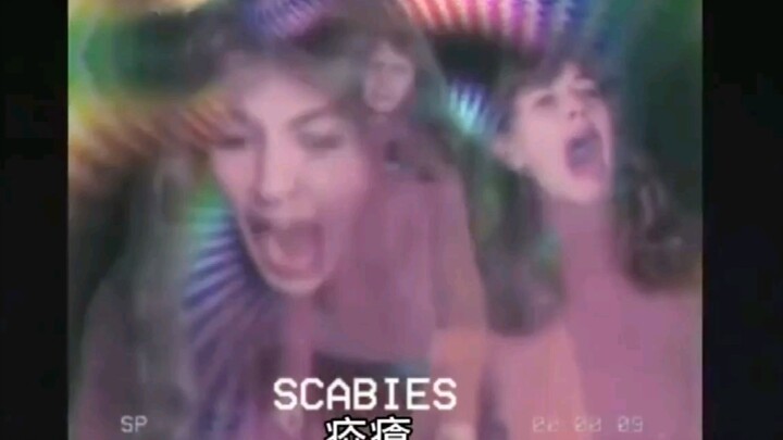 **Pendapat Putri tentang Penyakit Kelamin