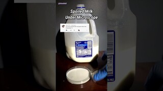 Spoiled Milk Under Microscope (Chunky and Expired)