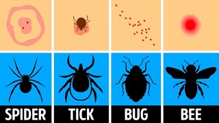 How to Identify a Bug Bite and What to Do With It