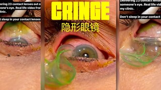 لا تنسَ خلع العدسات اللاصقة قبل النوم‼️⚠️تحذير TW⚠️