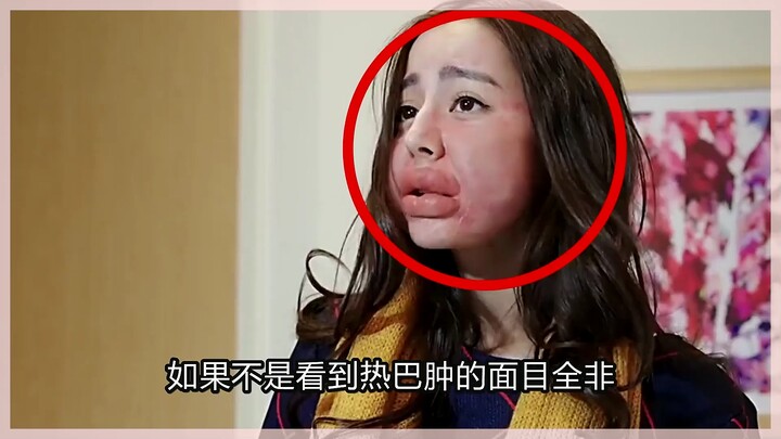 How big is the gap when celebrities go for a goofy look? Dilraba’s face is so swollen she’s unrecogn