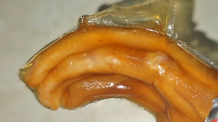 Suggest a thorough investigation—urine even smells like this!