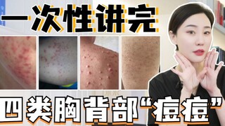 一次性讲完，四类胸背部“痘痘”！