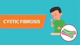 Cystic Fibrosis (pediatrics)