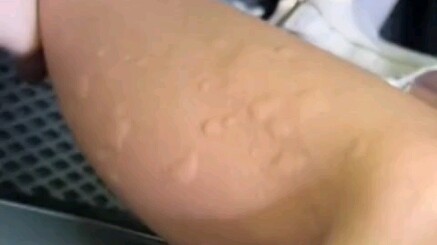 Damn it, these mosquitoes are so weak!