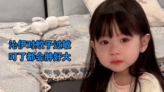 Tần Nghi bị dị ứng với muỗi, nàng nói chỉ có hung dữ mới có thể đuổi muỗi đi.