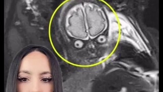 原来核磁共振成像大部分都很“惊悚”