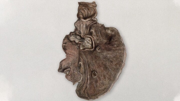 Một sinh viên ăn sushi trạm xăng nhặt từ đống rác – đây là những thay đổi xảy ra trong dạ dày của cậ