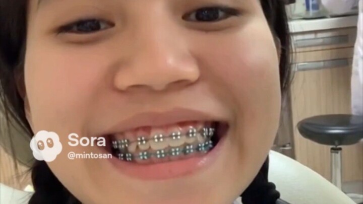 ดัดฟันในJakarta