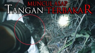 🔴 TANGAN TERBAKAR