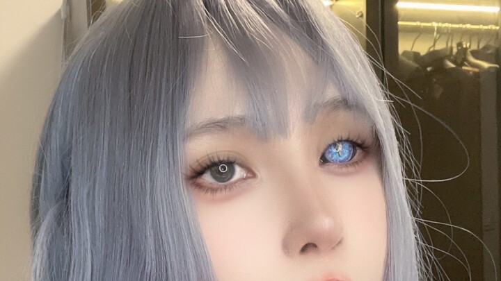 Thank you for naming my prosthetic eye!